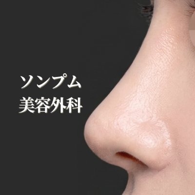 ソンプム美容外科｜韓国鼻整形・再手術
